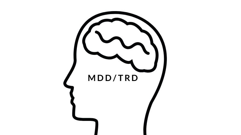 MDD/TRD 薬開発の成功例/未達例/進行中の比較表