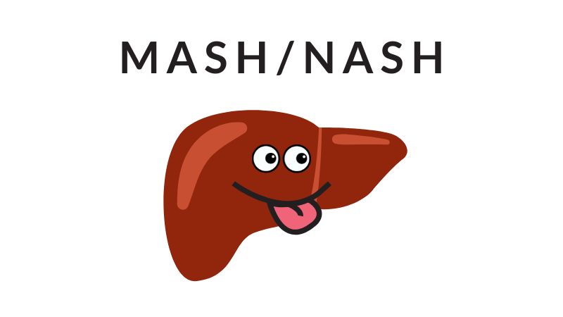 MASH/NASH 領域は FDA の追い風もあり活発化している